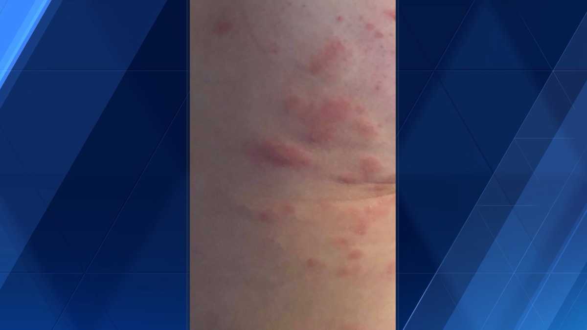 DUQUESNE INCLINE BEDBUGS: Duquesne Incline closed until Friday for ...