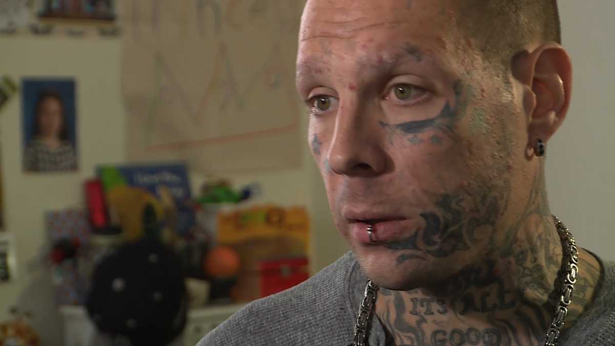 Recovering addict removes face tattoos to get back on track