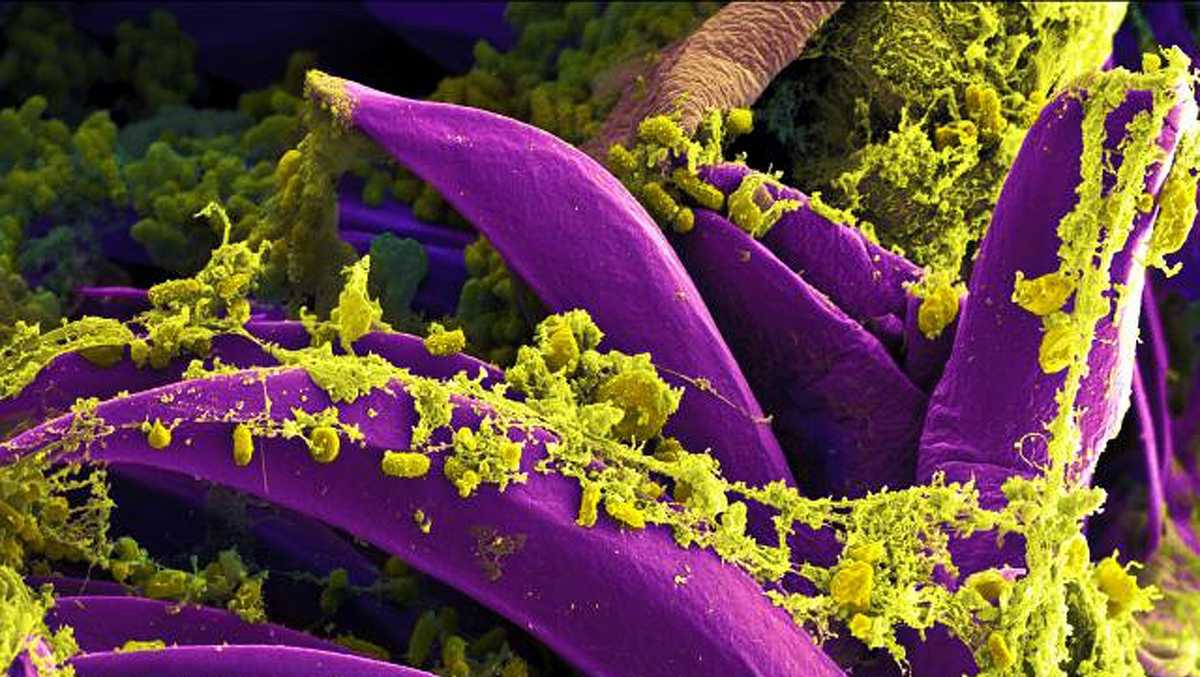 Two people just got the plague in China — yes, the Black Death plague