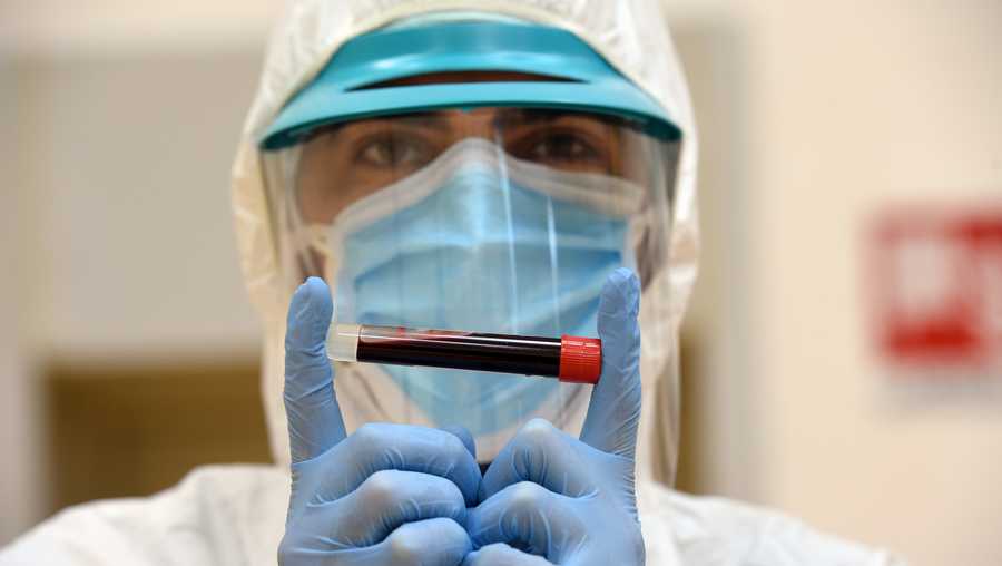 A healthcare professional shows a test tube with blood for a serological test that can identify who has contracted Coronavirus, perhaps in an asymptomatic form and has produced antibodies, on April 20, 2020 in Milan, Italy.