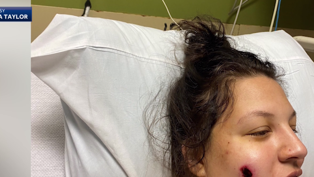 Pregnant mom, children shot at from outside southern Indiana home - Vimarsana News