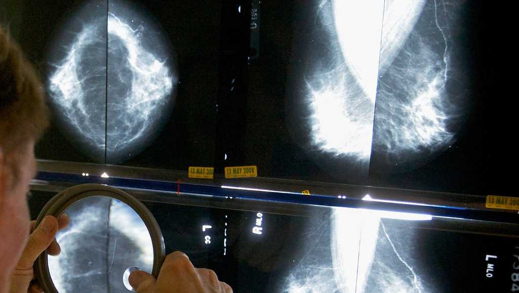 Pandemic disruptions to health care worsened cancer survival