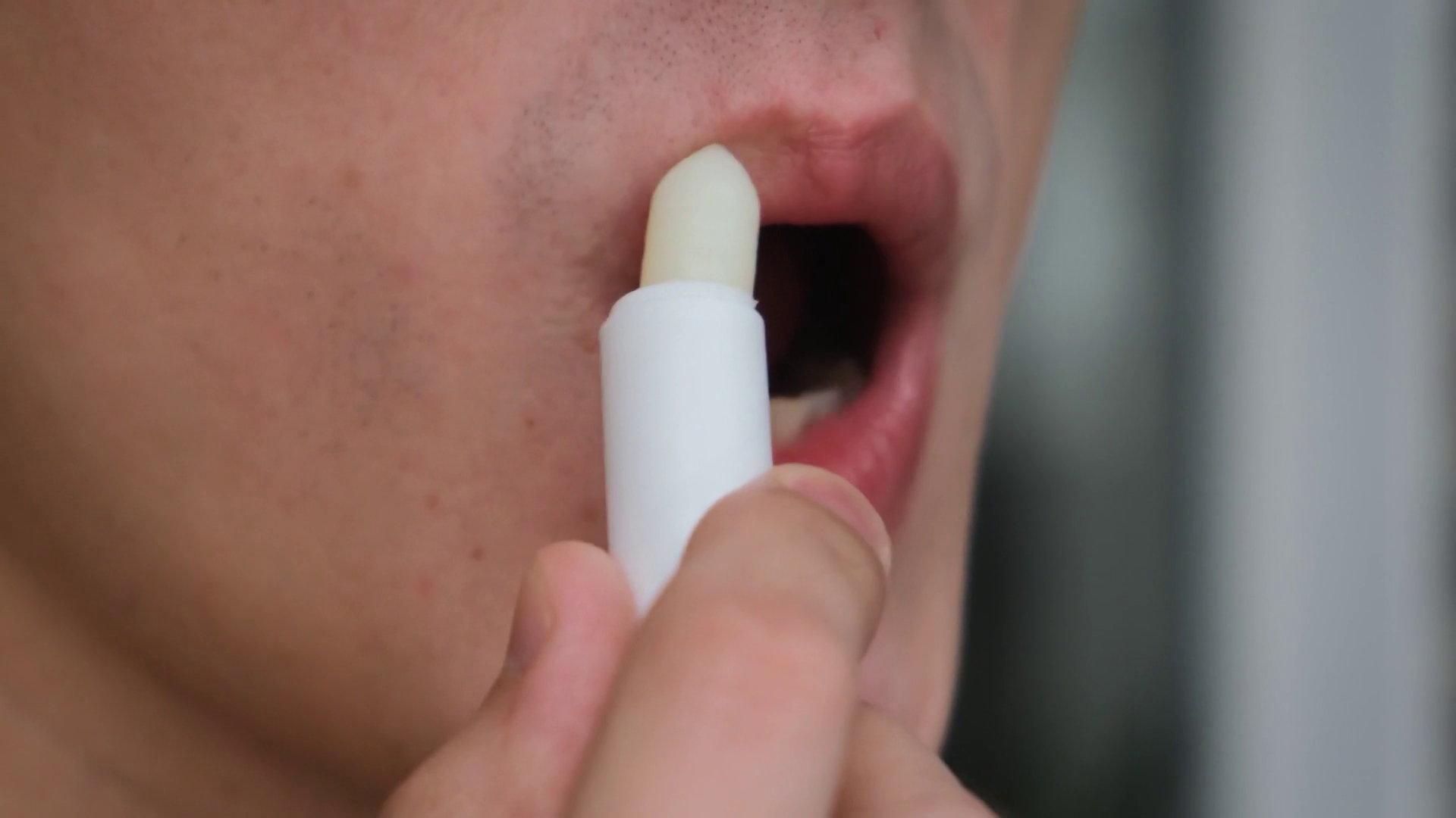 Doctor outlines keys to preventing chapped lips this winter - Vimarsana News