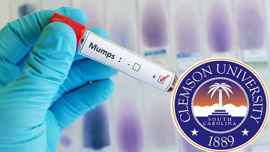 Blood sample with mumps virus positive