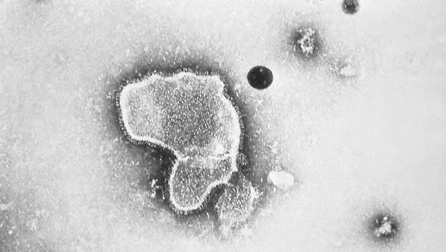 CDC vaccine advisers' vote in favor of RSV shot for older adults - Vimarsana News