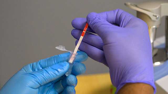 Xylazine present in more than 1 in 10 fentanyl US overdose deaths - Vimarsana News