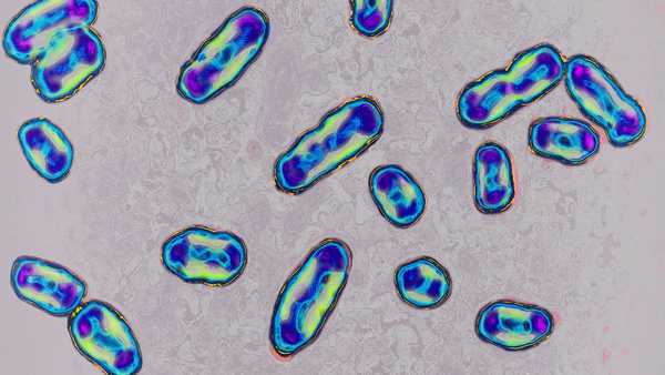 Yersinia pestis, the bacteria responsible for the plague, seen under optical microscope.