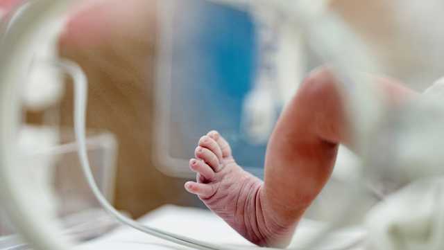CDC report: Maternal syphilis rates in US tripled in recent years - Vimarsana News