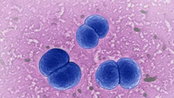 U.S. health officials are urging doctors to watch for certain types of rare, serious infections caused by the bacteria Neisseria meningitidis.