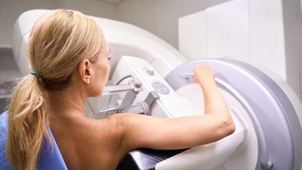 People should now starting getting mammograms at age 40, according to new recommendations.