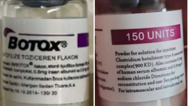 Consumers should report suspected counterfeit Botox products to FDA at 800-551-3989, according to the agency.