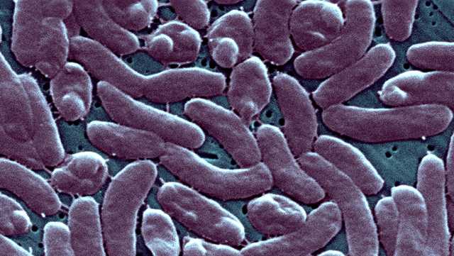 3 people die after flesh-eating bacteria infection in two states - Vimarsana News