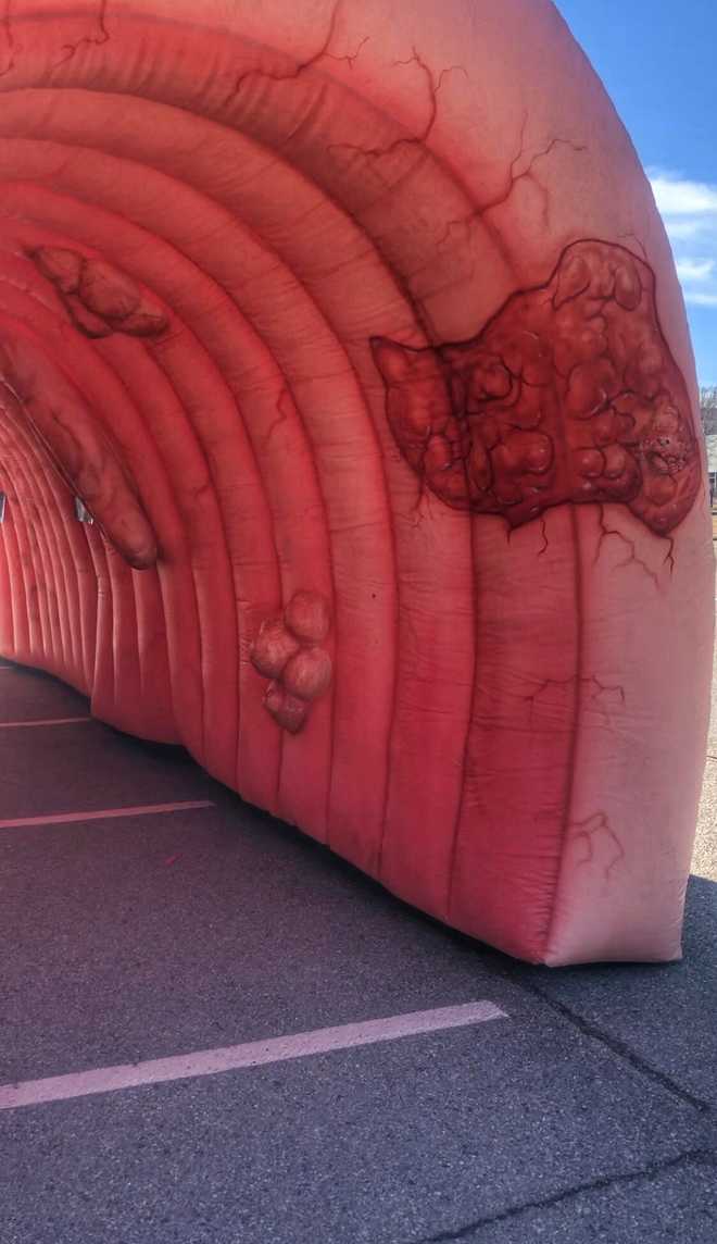 Small Inflatable Colon 30-foot inflatable colon coming to Heard On Hurd in Edmond