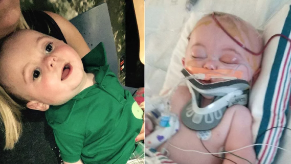 Mom speaks out after infant falls off bed, suffers brain damage: 'He's not the same'