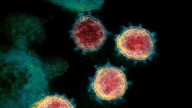 Vermont reports 197 new COVID-19 infections, 4 deaths - Vimarsana News