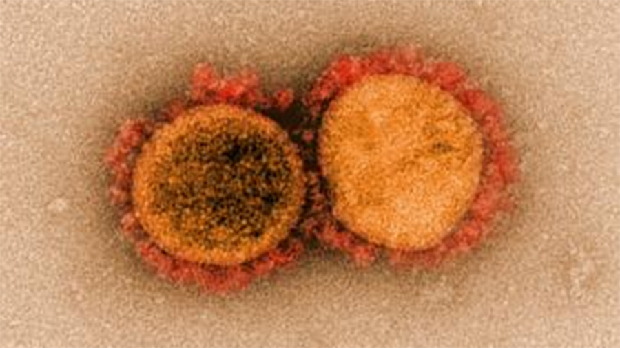 Coronavirus particles that cause COVID-19