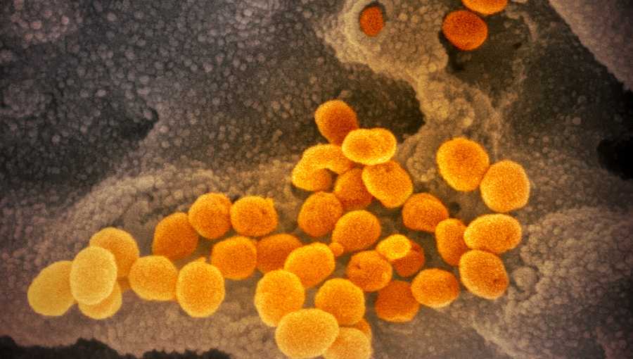 This scanning electron microscope image shows SARS-CoV-2 (orange) — also known as 2019-nCoV, the virus that causes COVID-19 — isolated from a patient in the U.S., emerging from the surface of cells (gray) cultured in the lab.