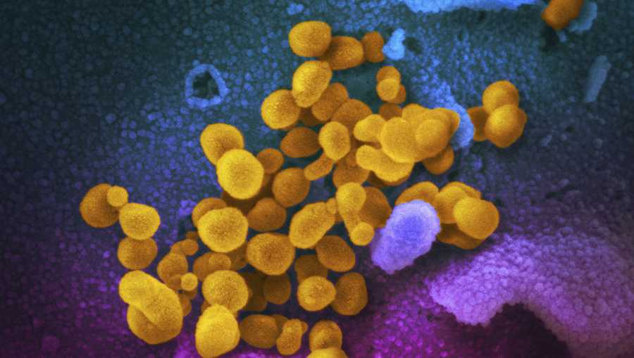 This undated electron microscope image made available by the U.S. National Institutes of Health in February 2020 shows the novel coronavirus, yellow, emerging from the surface of cells, bluepink, cultured in the lab the sample was isolated from a patient in the U.S.