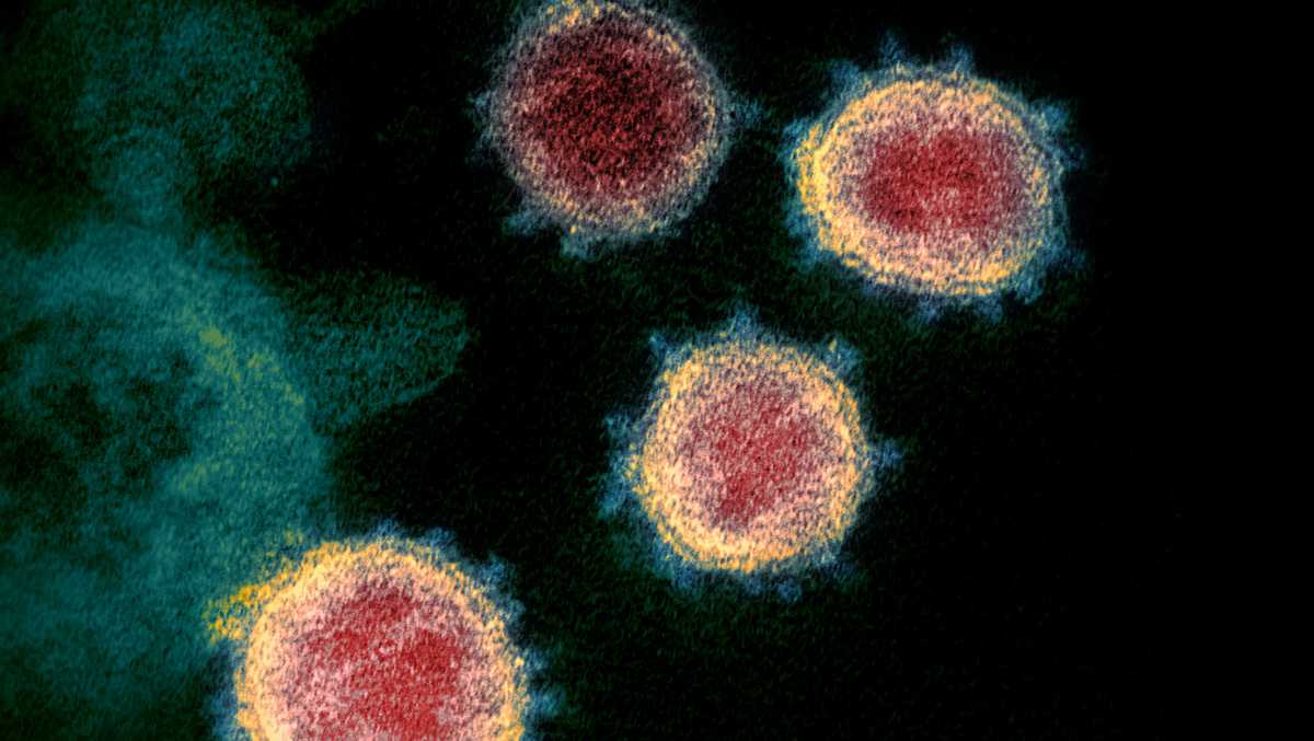 3,750 new COVID-19 cases, 67 additional deaths reported in Massachusetts - WCVB Boston