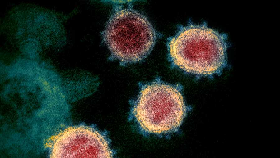 this undated electron microscope image made available by the us national institutes of health in february 2020 shows the novel coronavirus sars cov 2 also known as 2019 ncov, the virus causes covid 19 the sample was isolated from a patient in the us niaid rml via ap