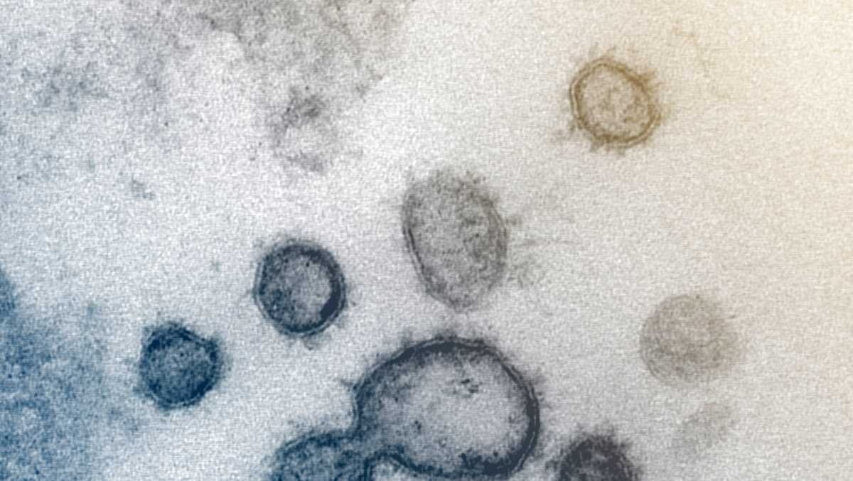 Inmate at Bridgewater prison tests positive for coronavirus, officials say - WCVB Boston thumbnail