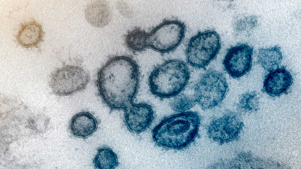 Sacramento COVID-19 vaccine trial needs more participants - KCRA Sacramento thumbnail