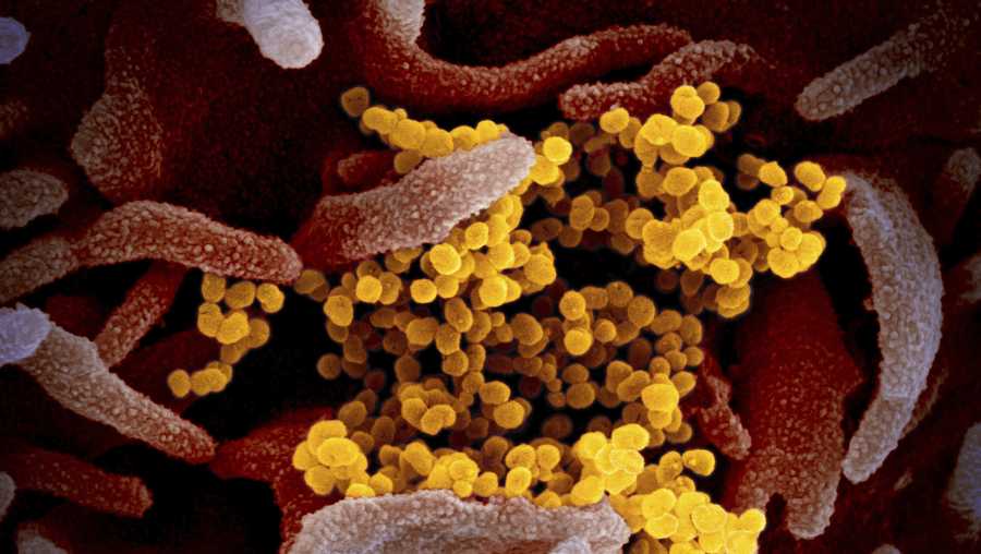 this undated electron microscope image made available by the us national institutes of health in february 2020 shows the novel coronavirus sars cov 2, yellow, emerging from the surface of cells, pink, cultured in the lab also known as 2019 ncov, the virus causes covid 19 the sample was isolated from a patient in the us on thursday, march 5, 2020, tennessee's department of health commissioner lisa piercey confirmed the state's first case of the new coronavirus niaid rml via ap