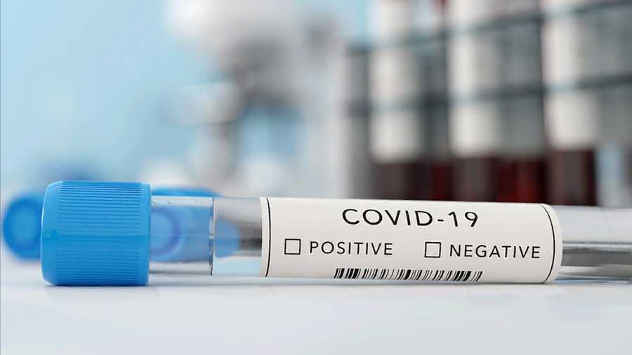 State of Wisconsin offering free at-home Covid-19 tests