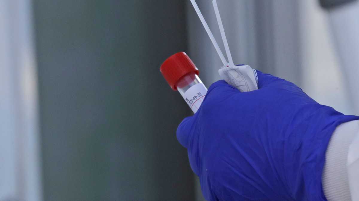 Kansas City Health Department says COVID-19 cases higher than reported Kansas City Health Department says COVID-19 cases higher than reported