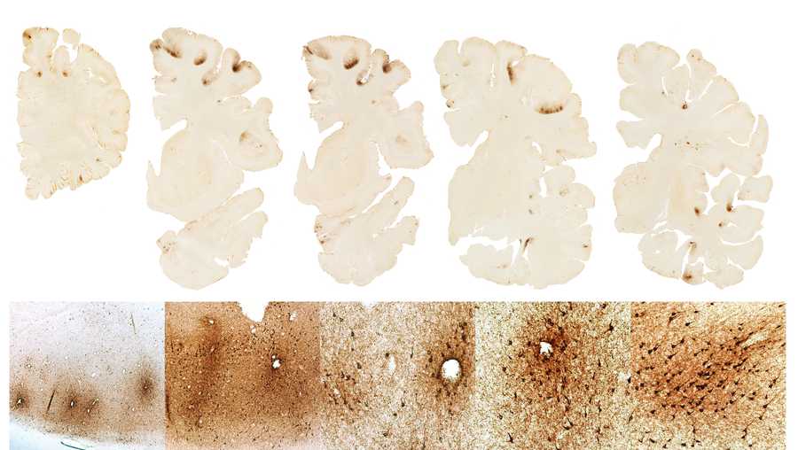 slices of human brain