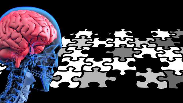 New treatment for Alzheimer's patients in Florida - Vimarsana News