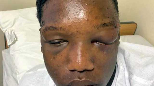 Columbia: Teen hospitalized after attack while in custody - Vimarsana News