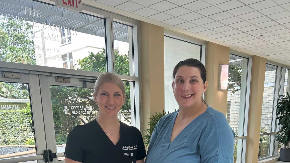 Florida doctor uses shoulder bone to rebuild patient's face