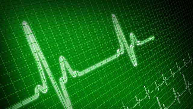 Heart disease diagnosed quicker in men than in women - Vimarsana News
