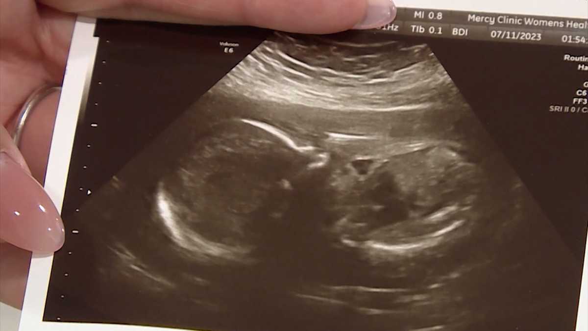 Fort Smith woman part of new lawsuit challenging Arkansas' near-total abortion ban