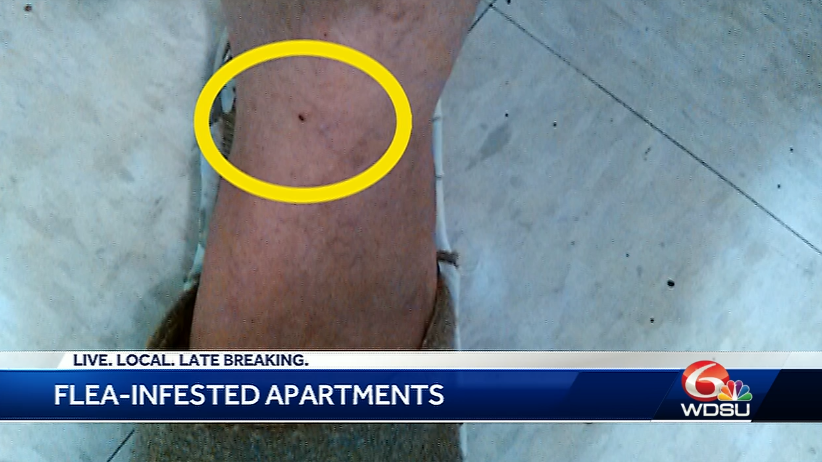 Tenants At Metairie Apartment Complex Complain Of Fleas And Ticks