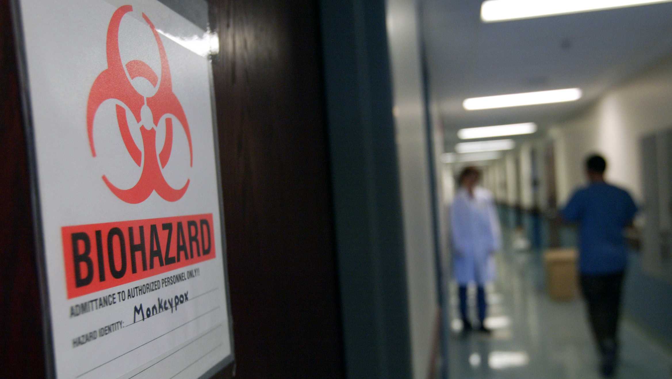 Get the Facts: CDC expert explains recent monkeypox outbreak - Vimarsana News