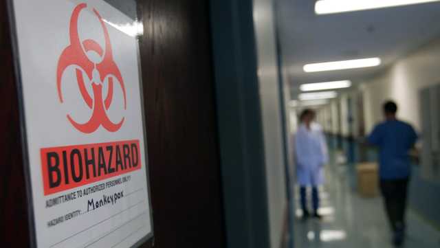 Get the Facts: CDC expert explains recent monkeypox outbreak - Vimarsana News