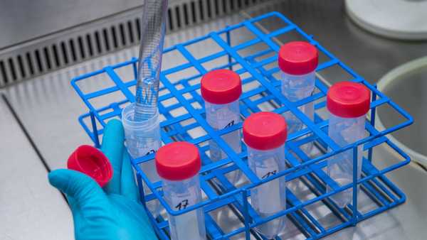 Swetlana Rot prepares water samples in a laboratory of the Saxony-Anhalt State Office for Environmental Protection in Halle/Saale. The scientists here examine wastewater for the coronavirus pathogen. Particles of it can be detected in human stool. The government wants to take advantage of this and set up a kind of early warning system via wastewater.