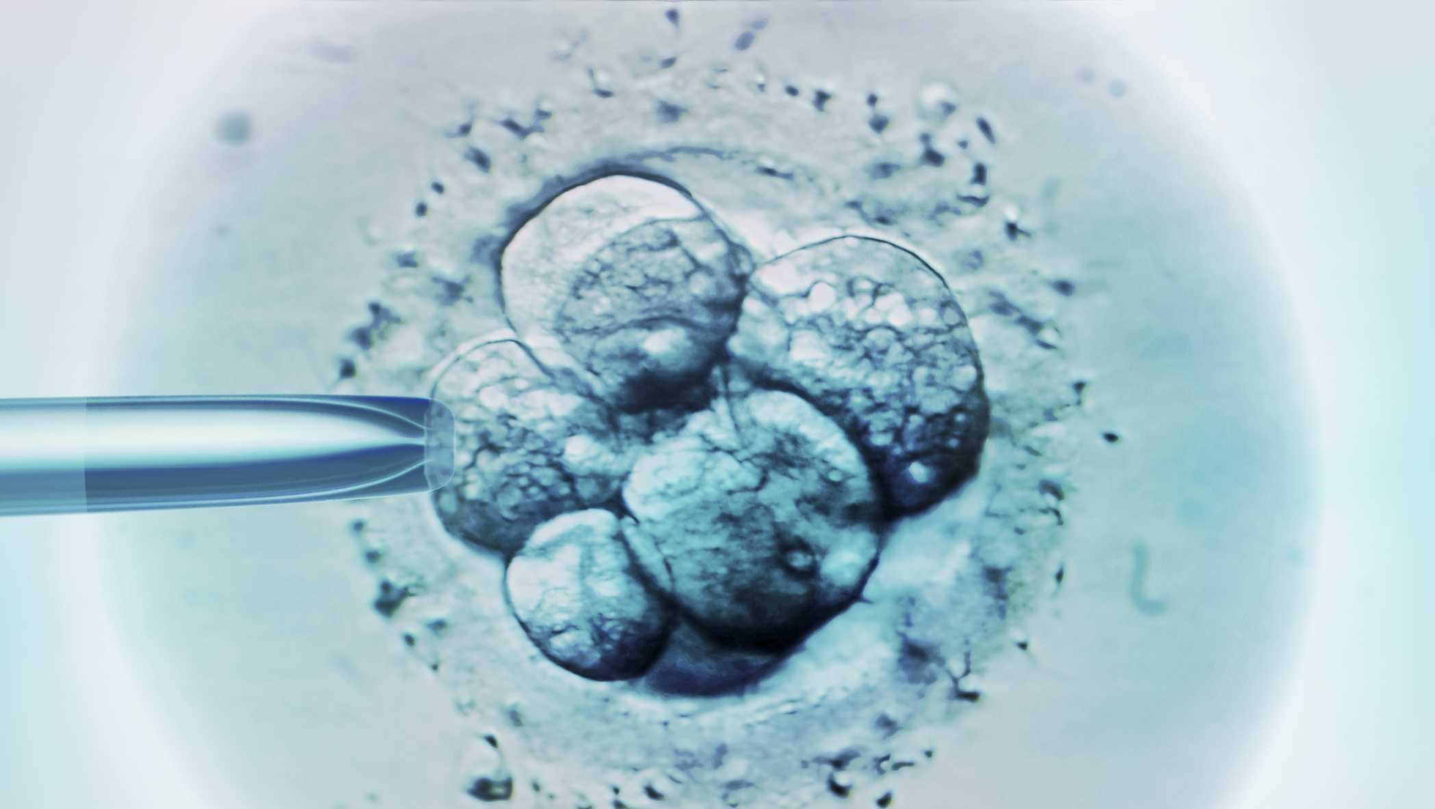 Second Alabama IVF provider pauses parts of its program after court ruling on frozen embryos - Vimarsana News