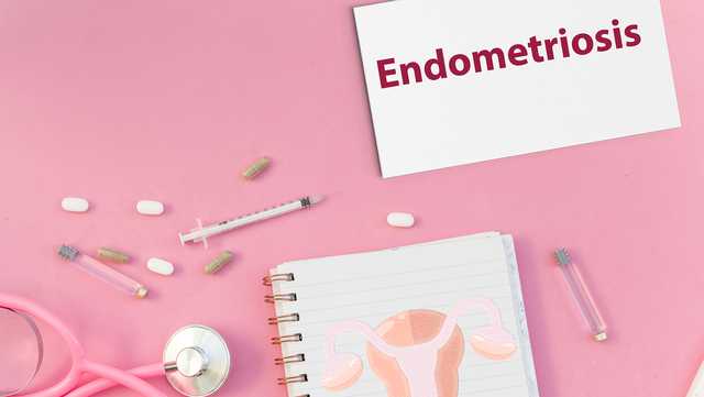 Endometriosis can lead to hysterectomy. Here's how - Vimarsana News