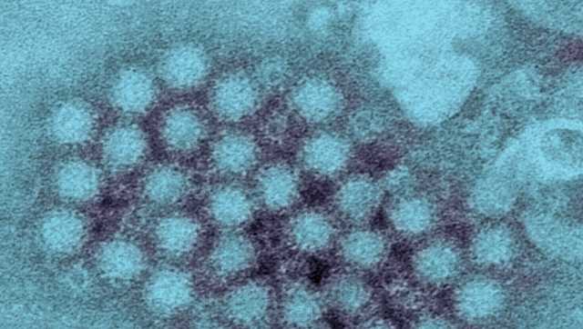 Will a norovirus outbreak happen in Cincinnati? TriHealth doctor says, 'We think it's coming.' - Vimarsana News