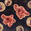 North Carolina teen dies from brain-eating amoeba