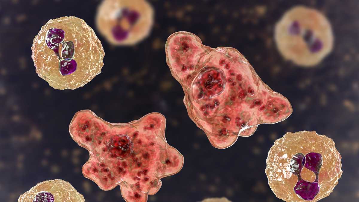 North Carolina Teen Hospitalized with Rare Naegleria fowleri Brain Infection