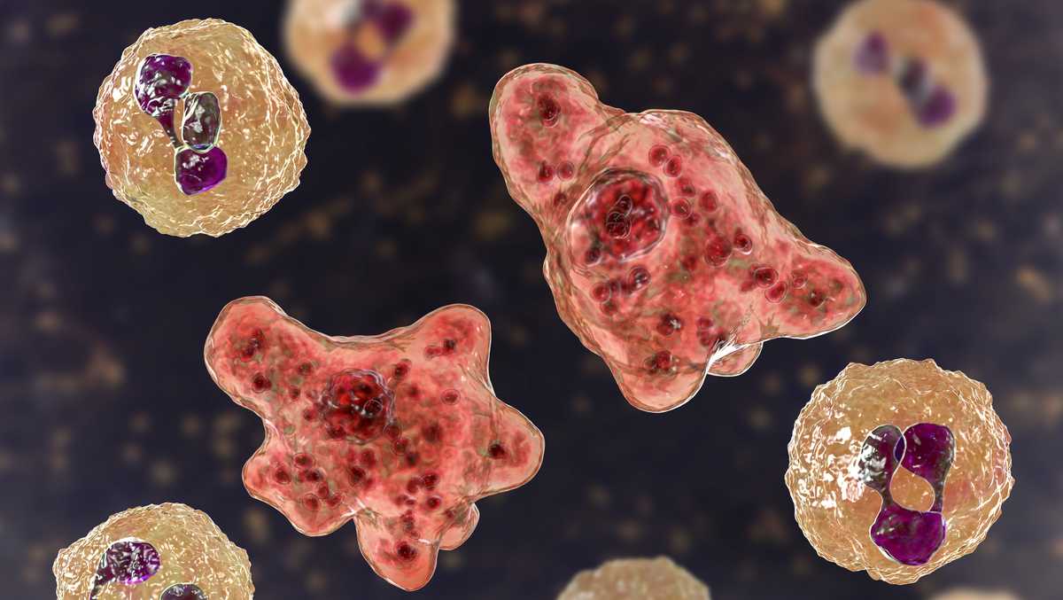 North Carolina teen dies from brain-eating amoeba