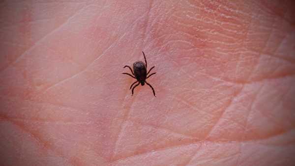 16 May 2024, Baden-Württemberg, Freiburg: A tick on the palm of a hand, photographed at the Kaiserstuhl in Baden-Württemberg. Photo: Frank Rumpenhorst/dpa (Photo by Frank Rumpenhorst/picture alliance via Getty Images)