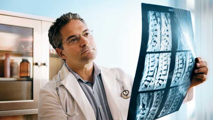 Doctor looking at MRI of spinal cord.