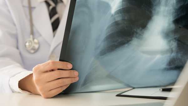 Radiologist doctor examining at lungs radiograph x-ray film of patient in roentgen room.
