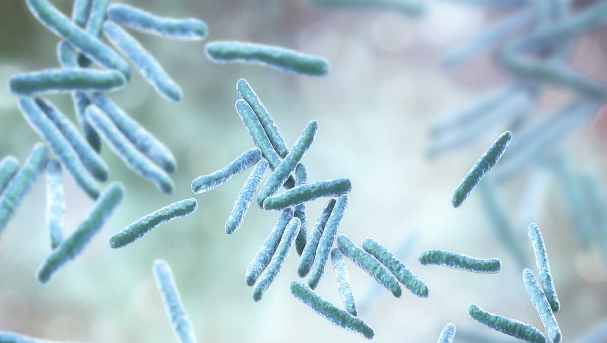 Monterey Trail High School Student Diagnosed with Tuberculosis: What Parents Need to Know