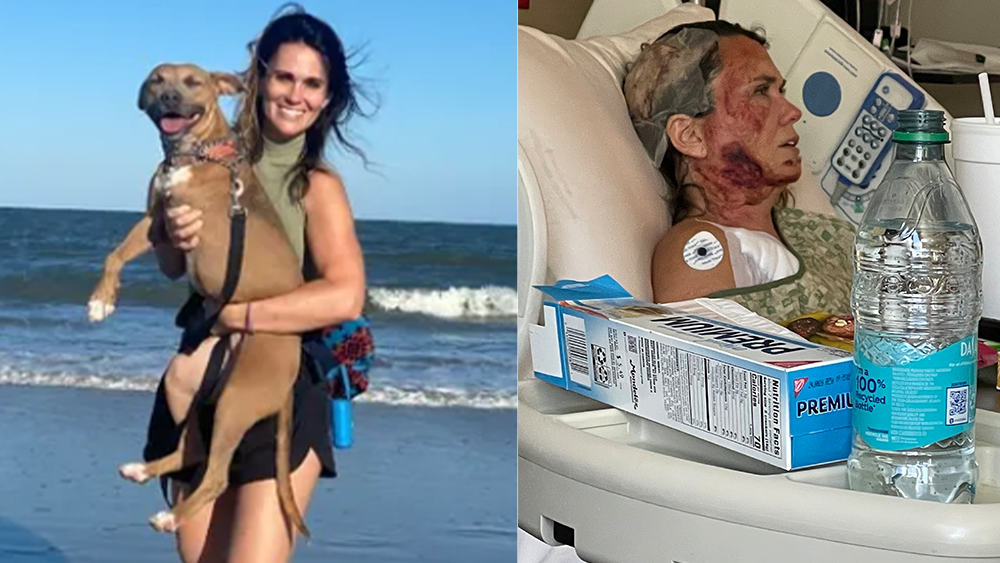 FBI offers reward after chemical attack leaves Georgia woman with third-degree burns